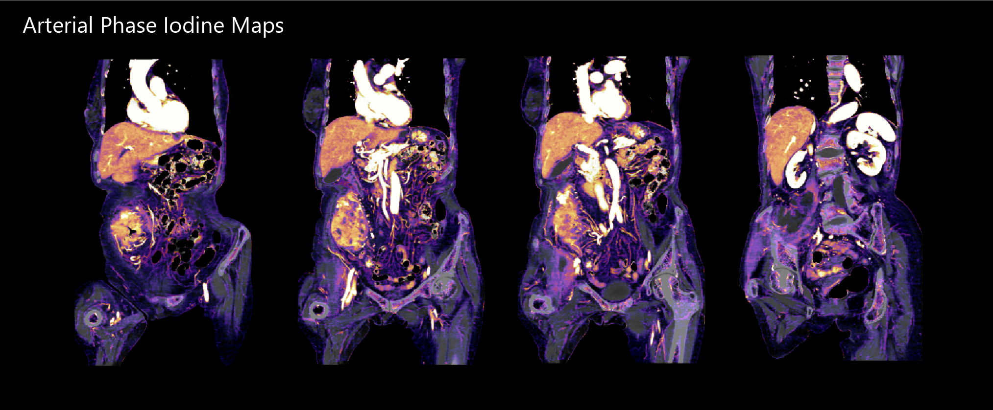 AiCE Abdomen & Pelvis