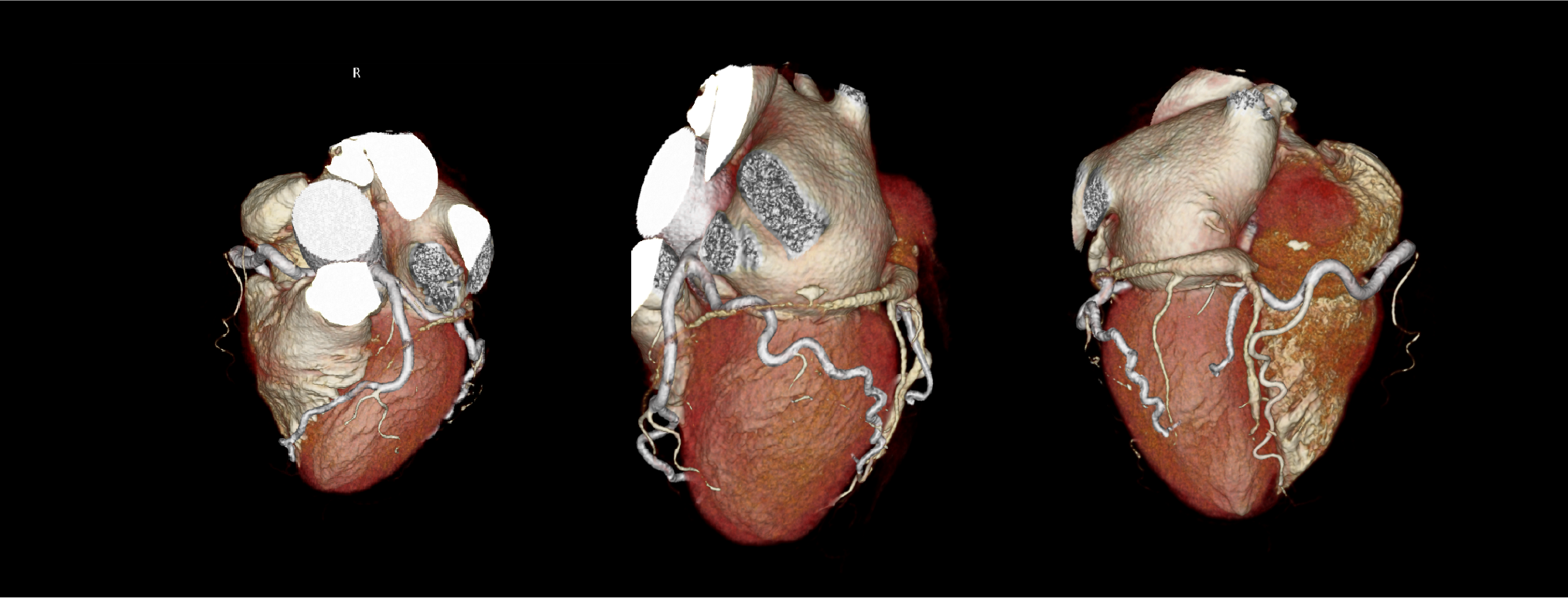 AiCE Cardiac