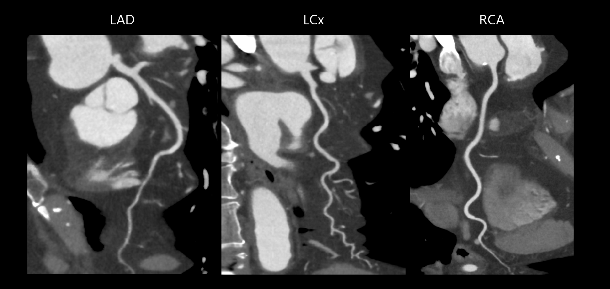 AiCE Cardiac
