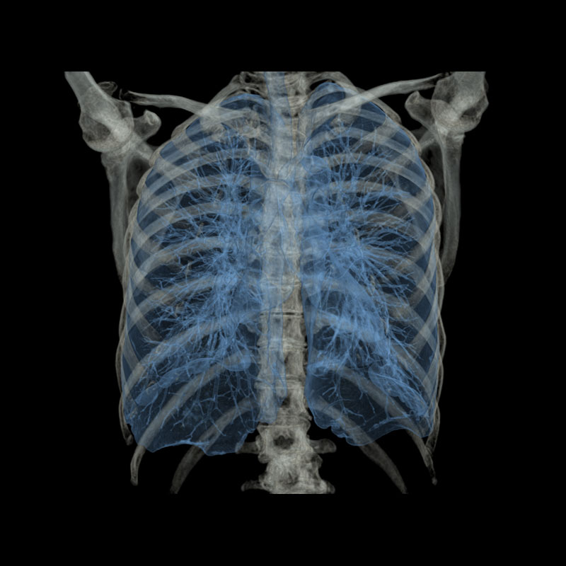 Chest Body Imaging 4