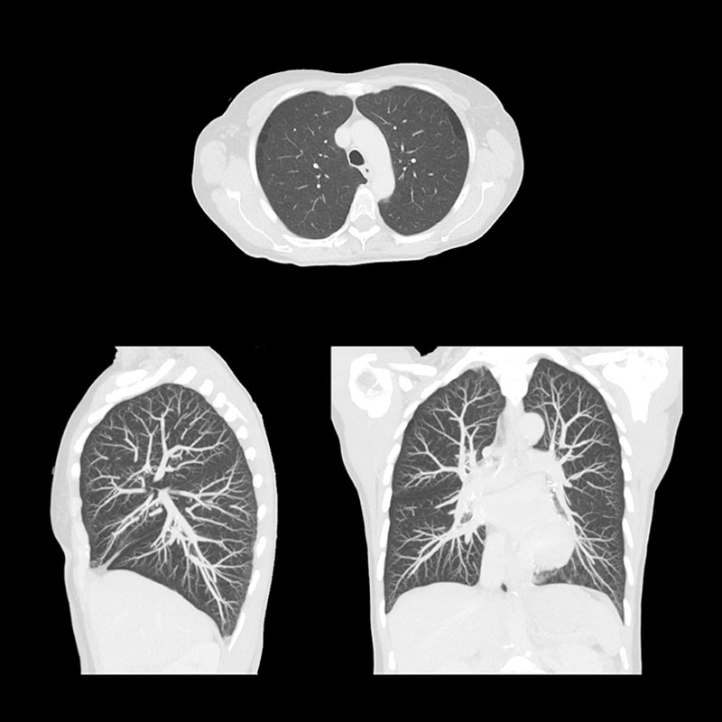 Chest Body Imaging 4