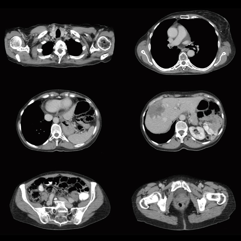 Chest, Abdomen, and Pelvis Body Imaging 5
