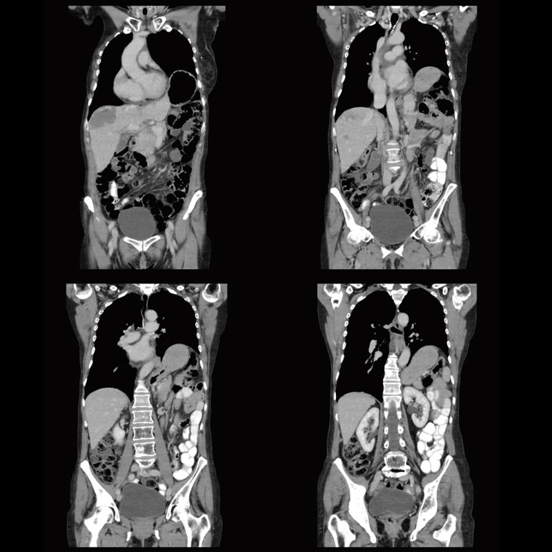Chest, Abdomen, and Pelvis Body Imaging 5