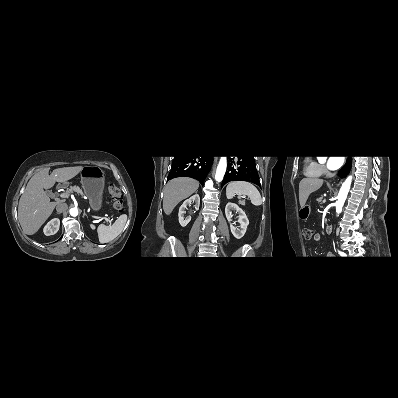 Abdomen Body Imaging 3