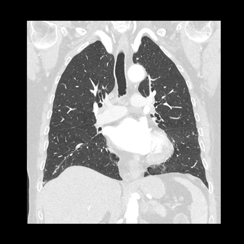 Chest CTA Body Imaging 1