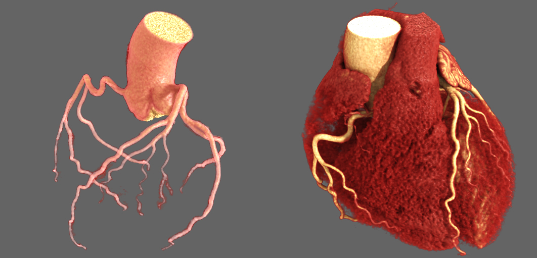 Cardiac Cardiac