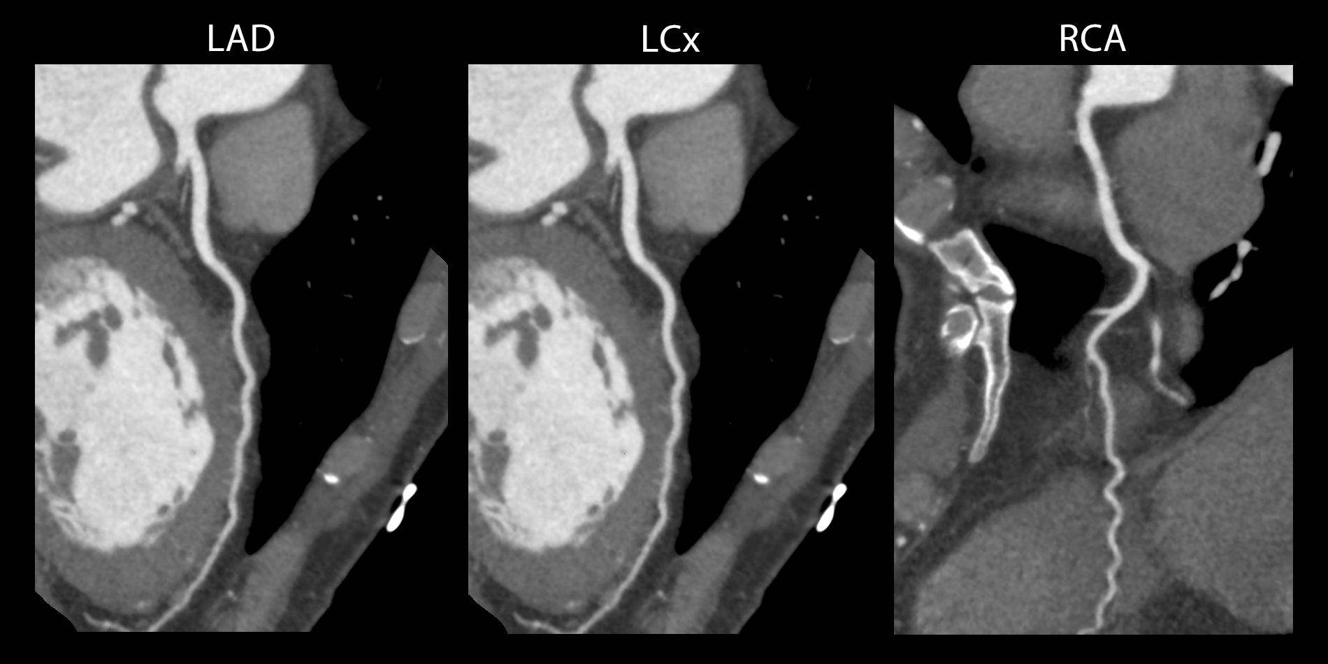 Cardiac Cardiac