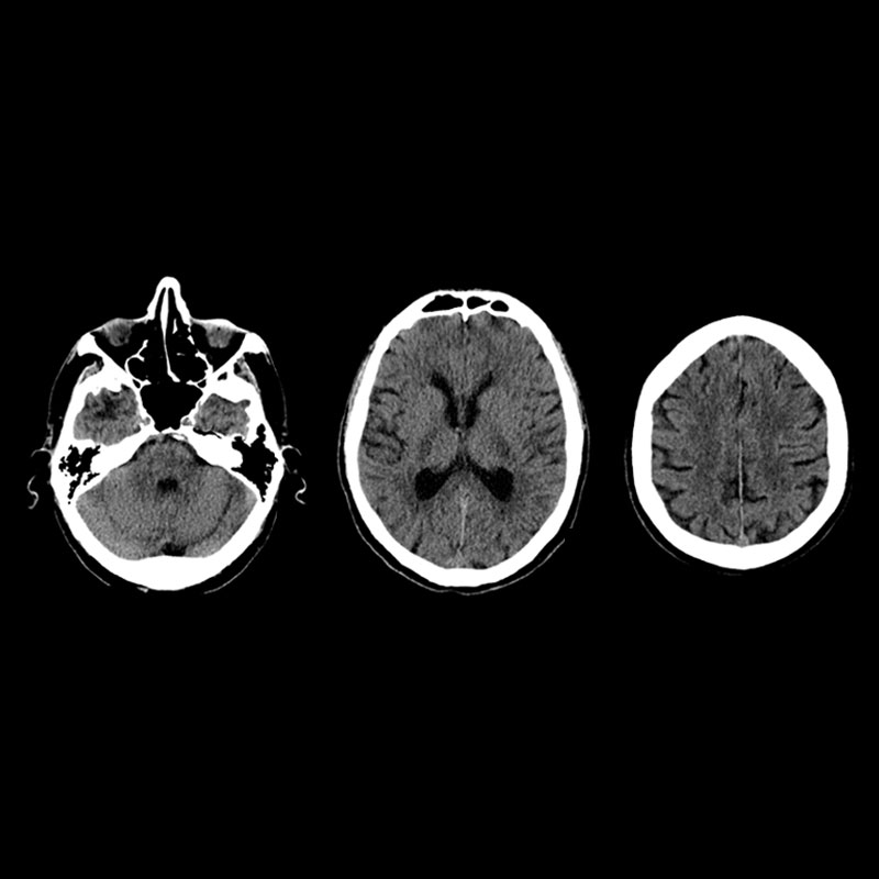 Brain Head & Neck 3