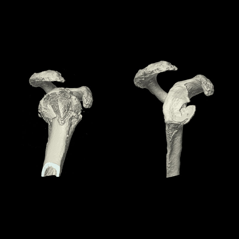Right Shoulder Musculoskeletal 4