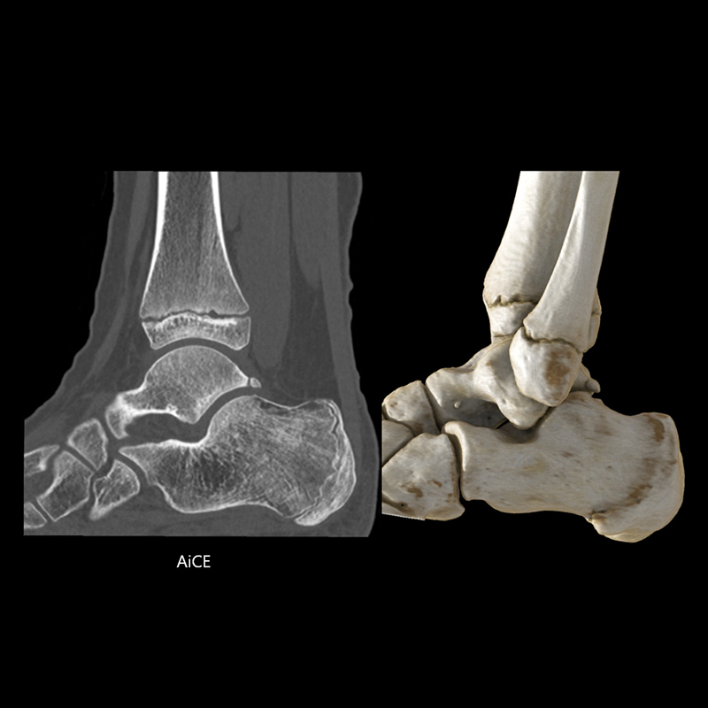 Ankle Musculoskeletal 1