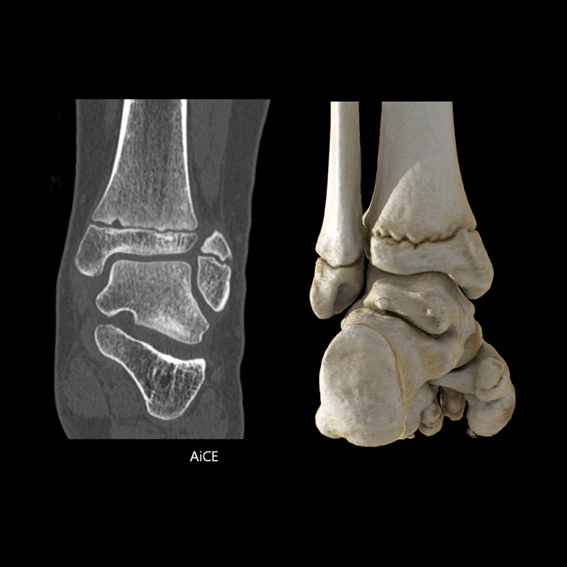 Ankle Musculoskeletal 1