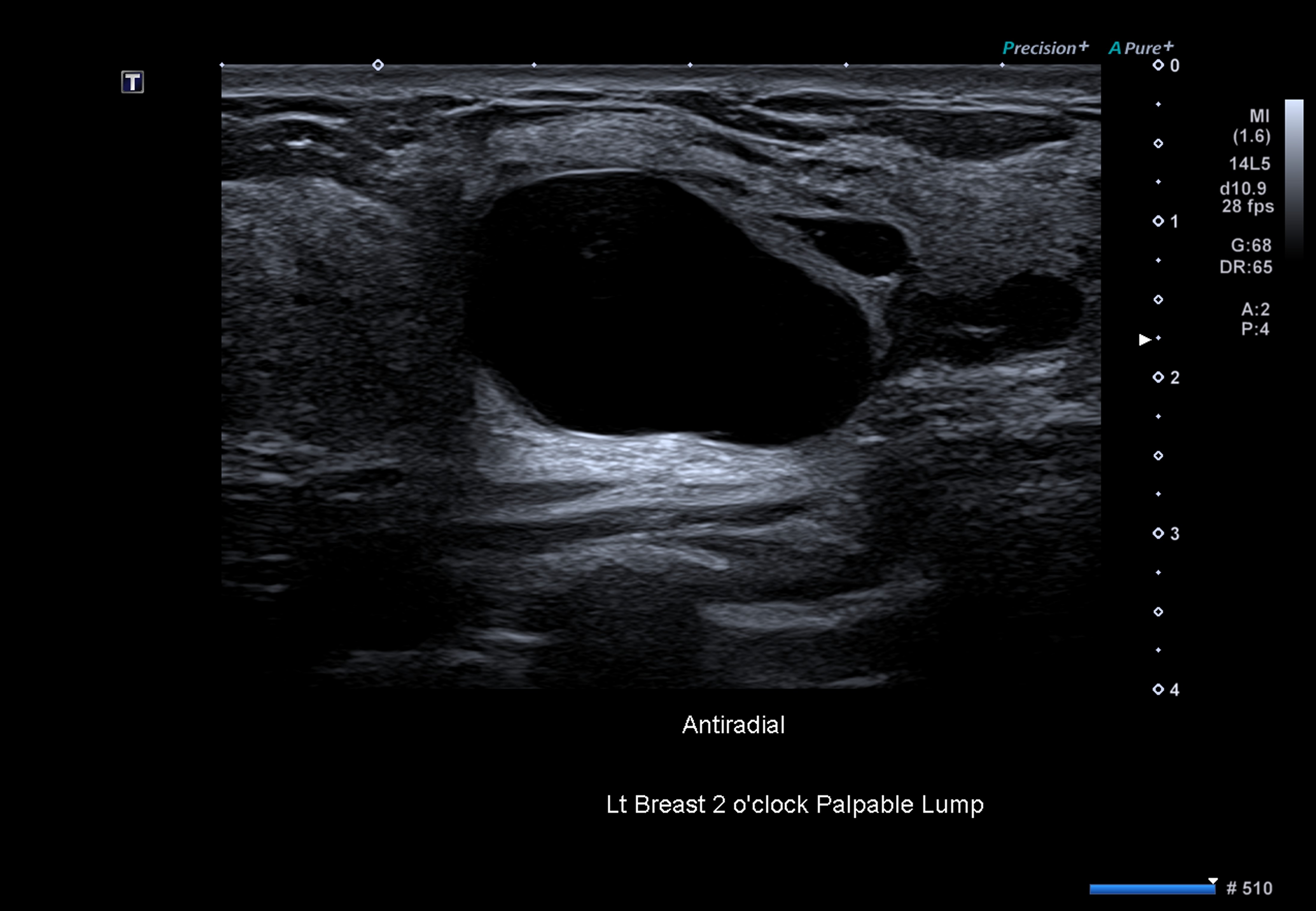 Breast imaging